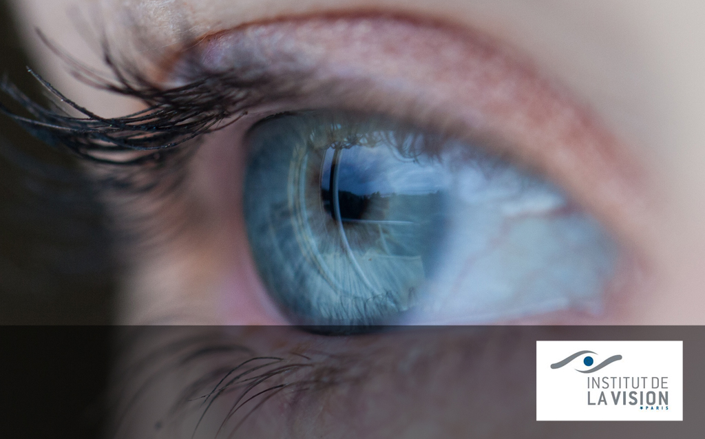 partenaire_vision