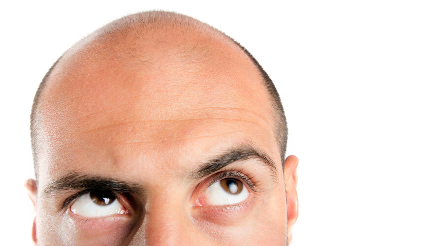 Cheveux : vers la fin de la calvitie ?