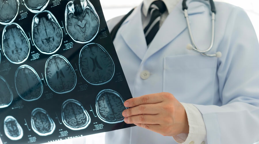 Cancer du cerveau : la recherche progresse